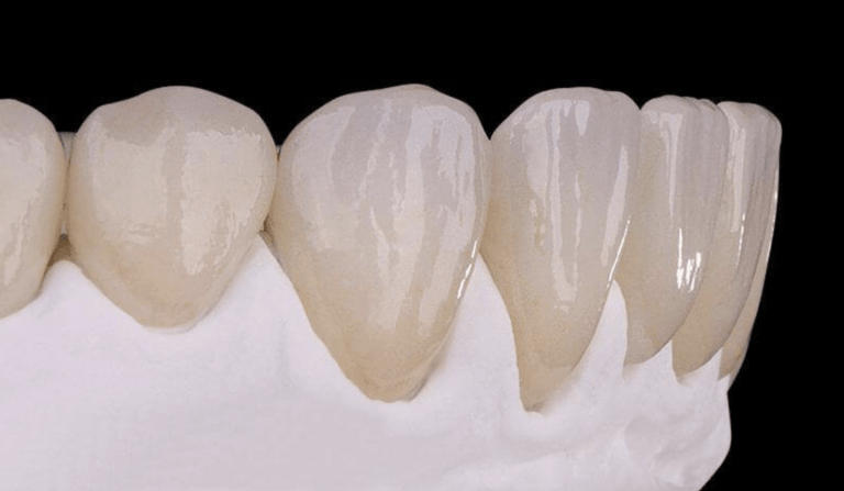 protocolo dentario facetas dentárias lentes dentarias facetas dentarias lentes dentárias dentística o que e dentistica o que é canal dentário coroas dentais alinhadores dentais periodontista o que faz o que é escaneamento o que e dentística protocolo dentário endodontista o que é dentista próximo tratamento de canal valor facetas odontológicas canal dentário valor faceta odontológica protocolo odontológico protocolo odontologico dentista bucomaxilo dentista rj dentista endodontista tratamento de canal dói mesmo com anestesia repouso após tratamento de canal protocolo dente dentista rio de janeiro odontofobia o'que sao facetas dentarias canal dente sintomas escaneamento digital o que e canal diferença entre lente e faceta canal dentario doi estetica odonto como evitar fazer canal no dente canal dentario como é feito clareamento preço canal dentario preço o'que é faceta nos dentes o que significa endodontia dentes desgastados para lente o que é protocolo dentário o que é protocolo dentario dentista zona sul o'que é protocolo dentário odontologia biomimética biomimética odontologia canal dentário dói odontologia humanizada clinicas odontologicas rio de janeiro implante dentario rj clinica odontologica rio de janeiro o que é canal dentario clareamento dental caseiro valor tratamento de canal sintomas resinas de porcelana canal de dente valor dental rio de janeiro dentistas rio do sul odonto clinica santos dumont protocolo dentista bucomaxilo cirurgia rj dente com canal dói com quente tratamento de canal precisa tomar antibiótico dentistica estética qual a diferença entre faceta de resina e porcelana clareamento dental laser preço qual a diferença entre lentes de resina e porcelana o que faz um periodontista dentista no rio de janeiro canal dentario o que é endodontista faz o que diferença entre resina e porcelana o que é um canal dentário clinica odontologica zona sul clínica odontológica zona sul dentista largo do machado dentista catete o que é odontologia estética diferença entre faceta de resina e porcelana dor apos primeira sessao de canal valor de canal dentária tratamento de canal como funciona escaneamento digital odontologia spa odonto o que significa dentística quem faz canal no dente tem que ficar de repouso quando faz canal o dente fica dolorido dentista na zona sul dentista flamengo como perder medo de dentista o que significa canal no dente implantes dentarios rio de janeiro implante dentário rio de janeiro resina porcelana odontologia zona sul lente de contato dental rj facetas de resina e porcelana diferença lente de contato dental vantagens e desvantagens clinica dentaria zona sul tipos de protocolo dentario protocolo dentário fotos endodontista rj facetas x lentes implantodontista rj facetas de resina rio de janeiro dentista zona sul rj o'que e protocolo dentario dentista protocolo dentista rio de janeiro rj clínica de estética zona sul rj resina para porcelana cirurgião dentista rj odontofobia sintomas dentista em rio de janeiro dentista para quem tem fobia implante rj clinica dentaria rj dentista flamengo rj o'que é odontofobia consultorio odontologico zona sul medo de dentista canal qual dentista cuida de canal protocolo dentario o que é como fica um protocolo dentario dentista leblon rj dentista no rj facetas de porcelana em dentes tortos dentista no catete rj faceta de resina e faceta de porcelana dentista rua do catete dentes tortos lente de contato dentista catete rj facetas para dentes tortos odontofobia tratamento clínica de implante dentário rj facetas de porcelana fotos implante dentario valor rj fobia a dentista dentista dentistica quando faz canal no dente pode comer consultorio odontologico rj facetas de porcelana rio de janeiro facetas de porcelana rj odontologia biomimética artigos medo de ir ao dentista fobia perder medo de dentista clinica dentaria rio de janeiro dentes tortos faceta de porcelana odontologia estética rio de janeiro dentista atm rj melhor clinica odontologica rj dentista largo do machado rj dentista 24 horas zona sul rj faceta porcelana durabilidade facetas de resina desvantagens tratamento de canal rj tratamento de canal preço rj tratamento de canal indolor dentista atm rio de janeiro faceta de porcelana e resina diferença facetas de resina rj como perder medo de ir ao dentista como fazer protocolo dentario medo de dentista como superar odontofobia como superar fobia de dentista o que fazer lentes de resina rio de janeiro o que significa ter medo de dentistas dentistica restauração rio de janeiro cl�nica dental para odontofobia quem tem fobia de dentista tratamento para odontofobia clinica odontologica zona sul rj dentista praia do flamengo 66 tratamento de canal zona sul rj clinica odontologica com sedação rj dentista praia do flamengo dentista praia do flamengo rj dentistas no largo do machado rj dentista dtm rj qual diferenca entre resina e porcelana dentistas catete rio de janeiro dentista dtm rio de janeiro dentista no bairro do flamengo dentista 24h flamengo tratamento de canal no rio de janeiro emergência dentista catete dente catete odonto dtm dentista flamengo rio de janeiro dentista especialista em dtm rj dentista em flamengo dentista ortodontia dtm dentista que faz canal rj clinica odontologica em rj clinica odontologica catete rj dental catete dentista zona sul rio de janeiro botox lente de contato dental facetas de resinas resina facetas de resina aparelho autoligado gengivas inflamada gengiva inchada lipo de la papada lipoplastia de papada facetas aparelho transparente faceta lipo de papada aparelhos transparentes frenectomia invisalign preço facetas de porcelana faceta de resina valores quanto custa um implante dentário radiesse antes e depois sculptra antes e depois facetas de resina valores aparelho invisalign facetas de resina valor faceta de resina valor implante dentario valores aparelho invisivel lentes de resina preenchimento aparelhos invisivel clareamento preenchimentos lentes de resinas implante dentario valor lentes de contato dentais valor lentes de contato dentais valores facetas de resina antes e depois lente de contato dental valores gengivoplastia antes e depois torus mandibular gengivectomia tórus palatino resina no dente palato alto bolha na gengiva facetas em resina clareamento dental antes e depois clareador dental antes e depois clareamento dental valores frenectomia lingual aparelhos convencionais bolhas na gengiva clareamento dental preço gengivoplastia valor gengivite tratamento ceu da boca inflamado anquilose dente de resina clareamento a laser invisalign antes e depois gengivoplastia valores dor no ceu da boca dor na gengiva aparelho ortodôntico autoligado tórus lipo papada harmonização orofacial botulínica toxina lipoaspiração papada aparelho estéticos aparelho estético aparelho porcelana bigode chinês antes e depois caroço na boca toxinas botulínicas aparelhos esteticos lentes de resina valor torus aparelhos estéticos lente de resina valor carocinho na boca hof o que e botox ossos palatinos céu da boca inchado aparelho transparente valor preenchimento fácial bioestimuladores de colageno antes e depois ferida na gengiva invisalign valor bioestimuladores de colágeno antes e depois resina dente